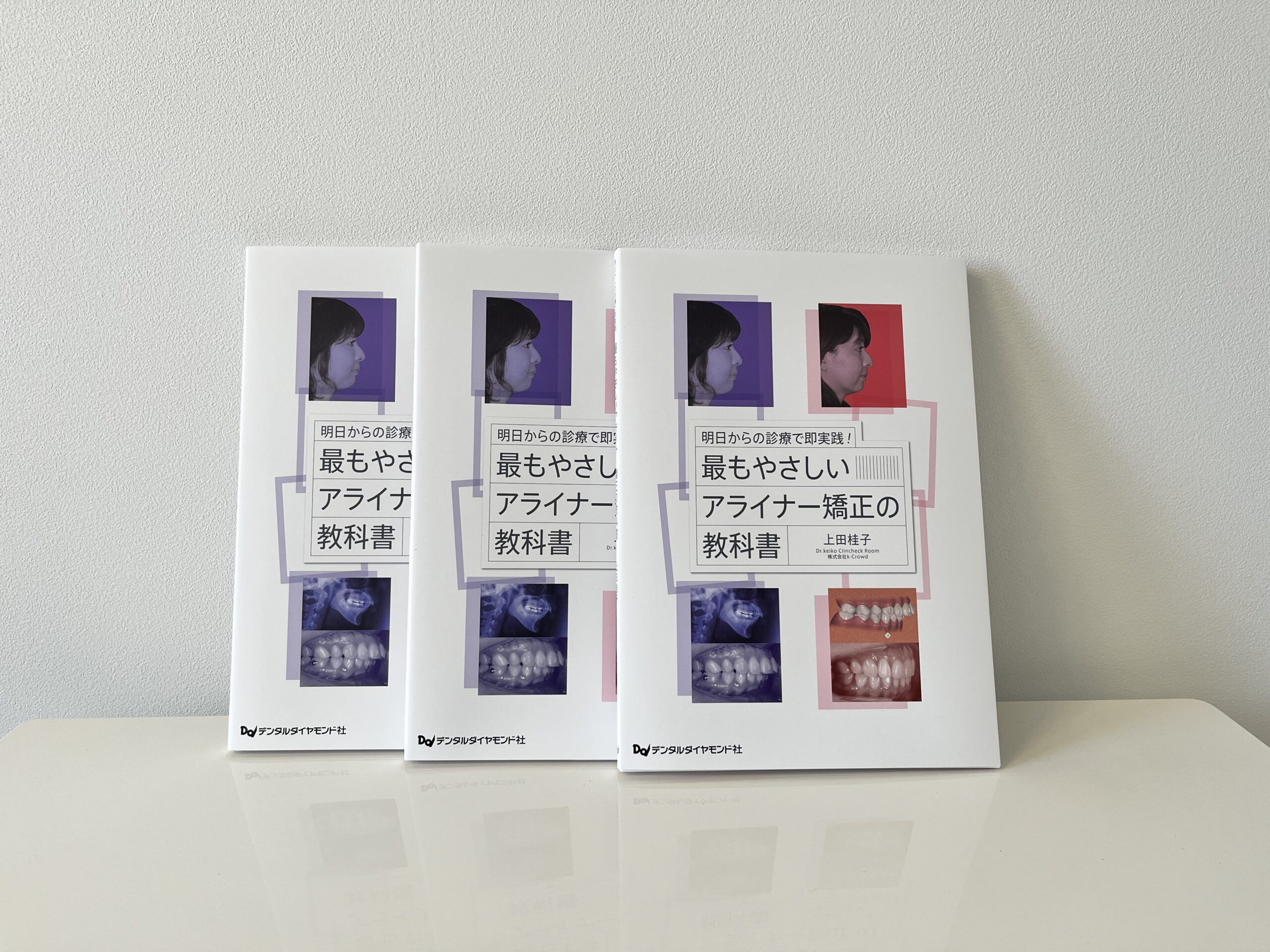 上田桂子先生の初著書「最もやさしいアライナー矯正の教科書」の内容とは？